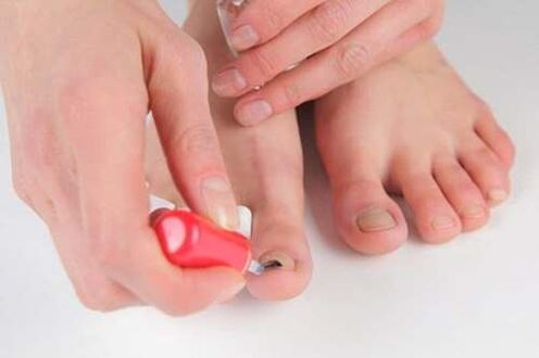Nail varnishes