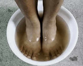 Rules for treating nail fungus