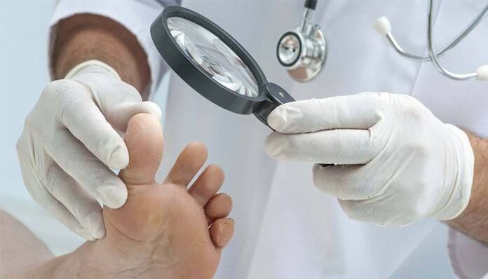 examination of feet for fungus between the toes