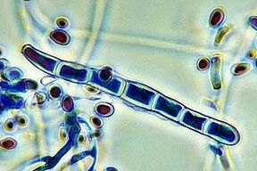 nail fungus pathogen under a microscope
