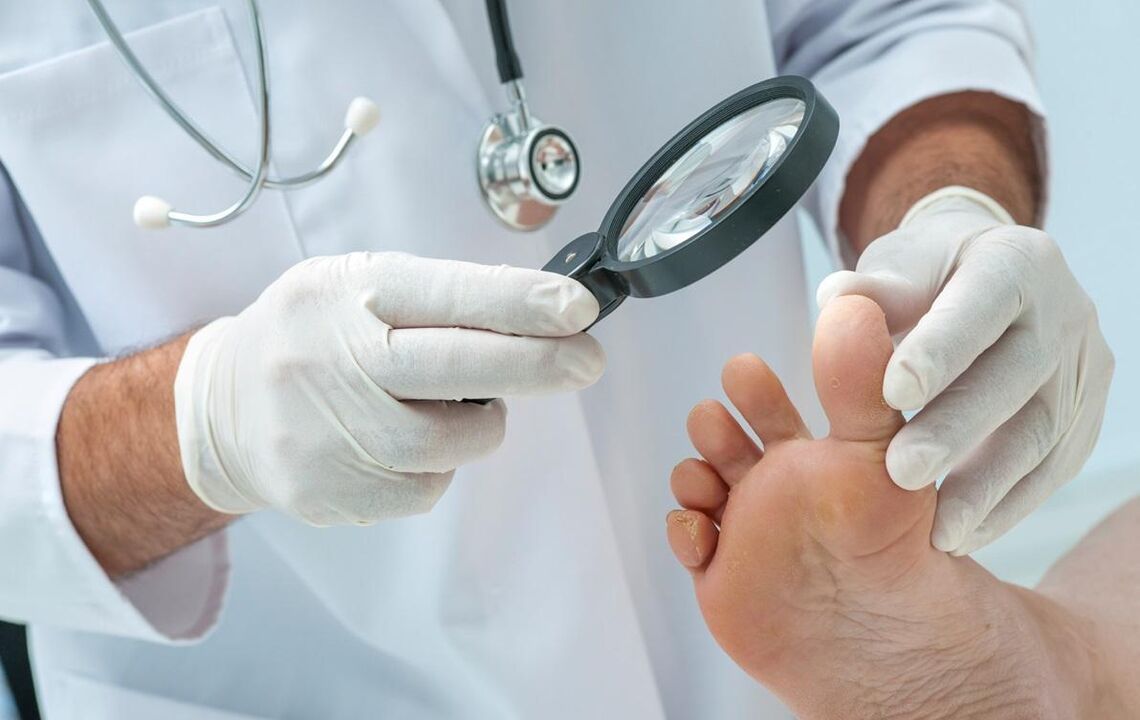 doctor examines nails for fungus